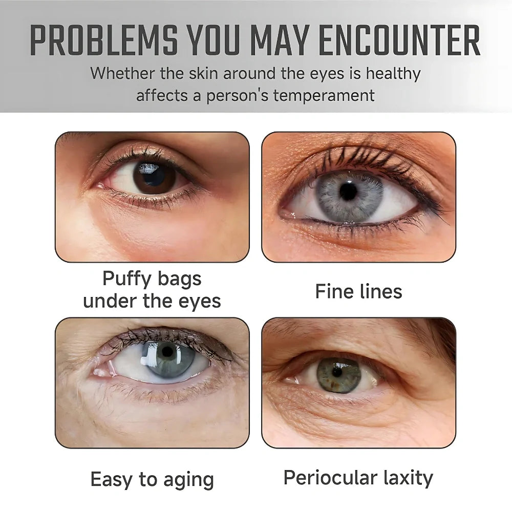 Dinkiss Lutein Eye Essence Oil || 🔥 BUY 1 GET 1 FREE 🔥